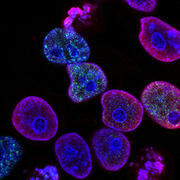 test tubes