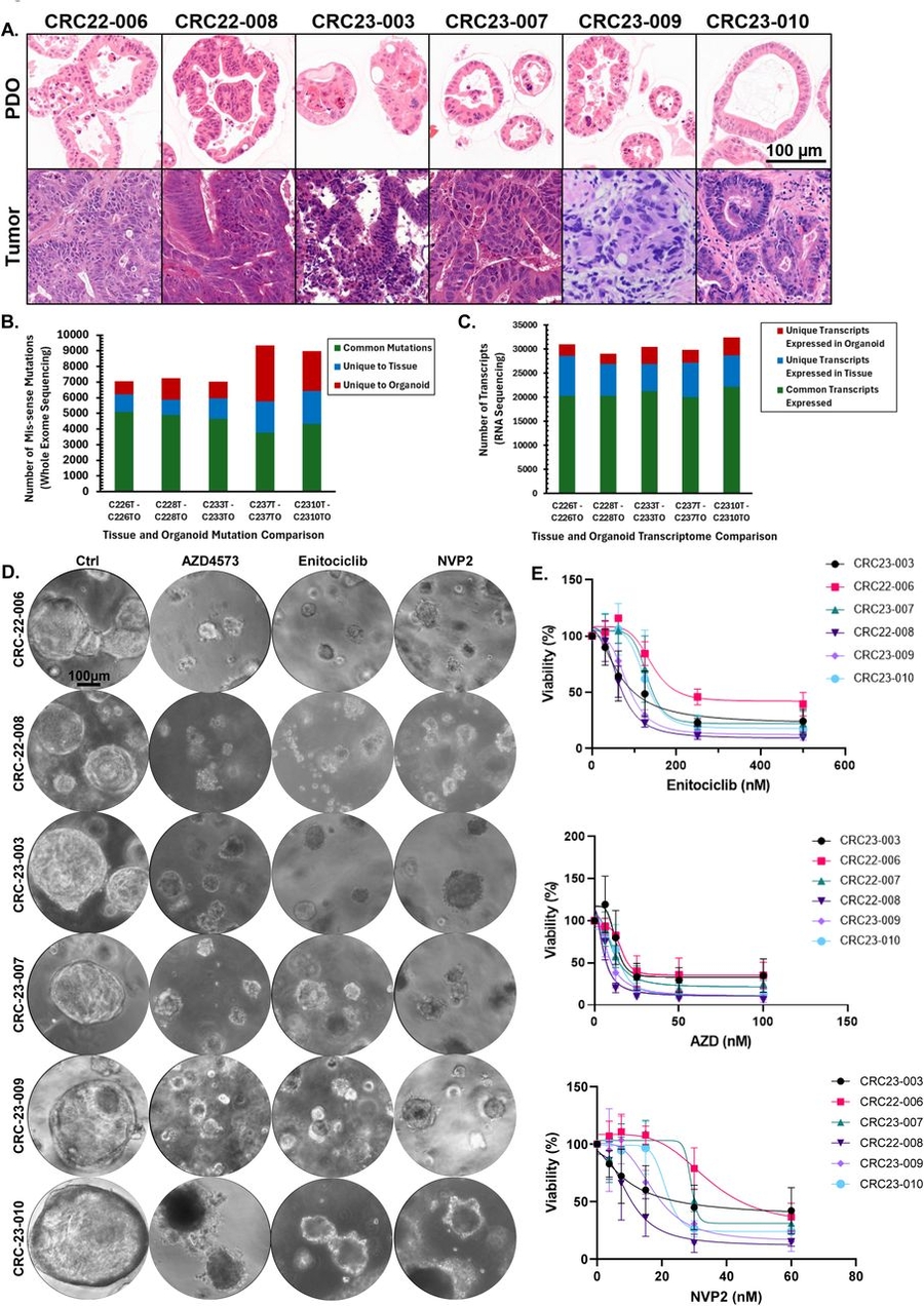 CDK9 Effect in CRC PDOs
